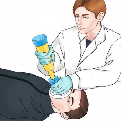 Choking Rescue Device
